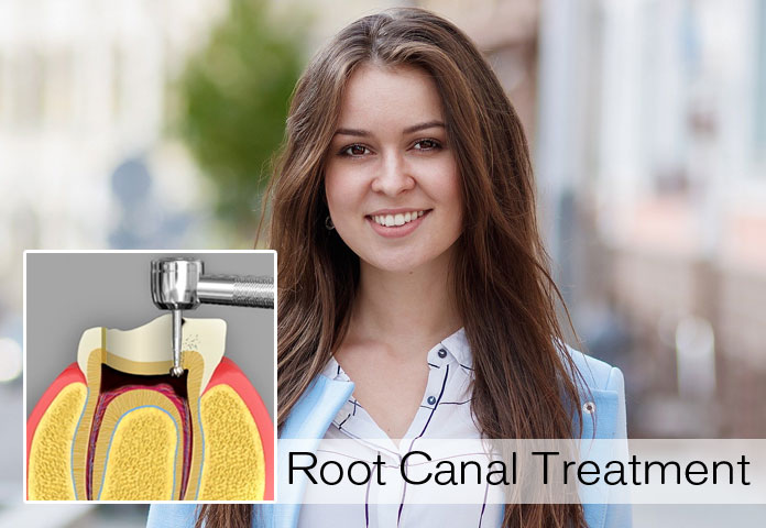 Seven Familiar Indications Conveying That You Require a Root Canal Treatment
