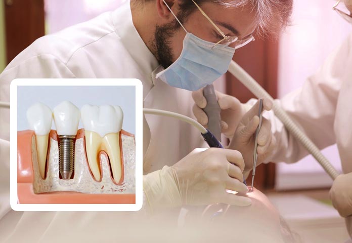 Why Choose an Oral Surgeon for Dental Implants? | Cary NC